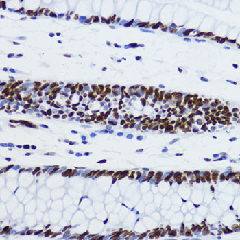 Acetyl-Histone H2B-K12 antibody