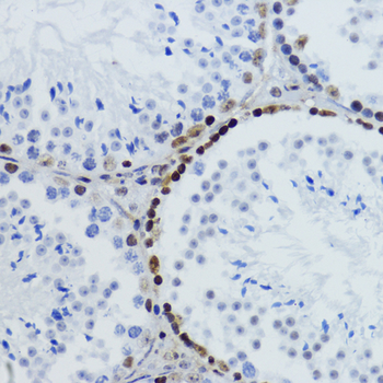 Acetyl-Histone H2B-K12 antibody