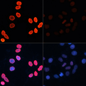 Acetyl-Histone H2B-K15 antibody