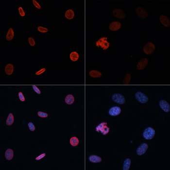 Acetyl-Histone H2B-K15 antibody