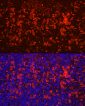 CD4 antibody