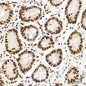 AKT1 (Phospho-S473) antibody