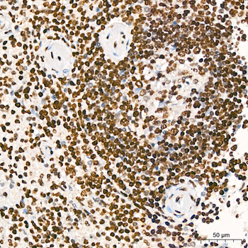 AKT1 (Phospho-S473) antibody