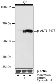 AKT1 (Phospho-S473) antibody