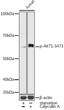 AKT1 (Phospho-S473) antibody