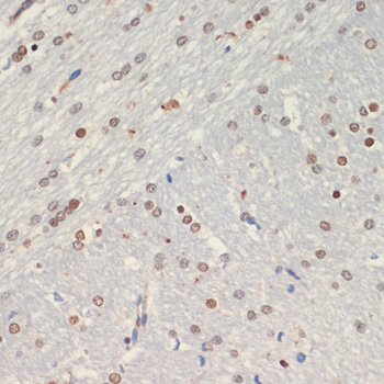 OLIG2 antibody