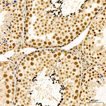 SMAD2 (Phospho-S467) antibody