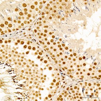 SMAD2 (Phospho-S467) antibody