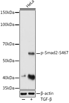 SMAD2 (Phospho-S467) antibody