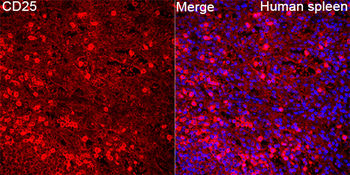 IL2RA antibody