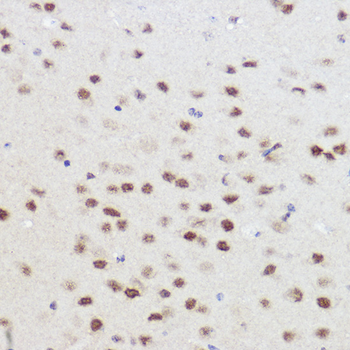 PRMT1 antibody