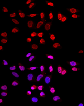 PRMT1 antibody