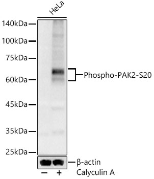 PAK2 (Phospho-S20) antibody