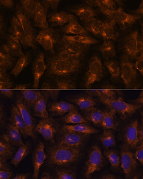 IFITM3 antibody