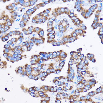 IL23R antibody