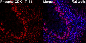 CDK1 (Phospho-T161) antibody