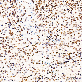 CDK1 (Phospho-T161) antibody