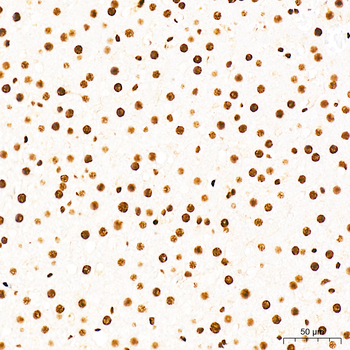 CDK1 (Phospho-T161) antibody