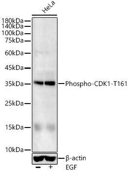 CDK1 (Phospho-T161) antibody