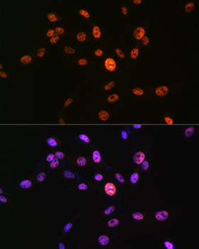 Histone H3 (Phospho-S10) antibody