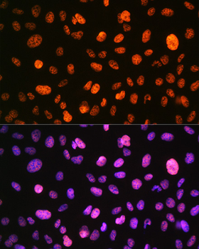 Histone H3 (Phospho-S10) antibody