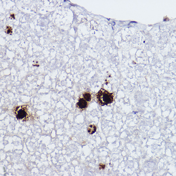 Histone H3 (Phospho-S10) antibody