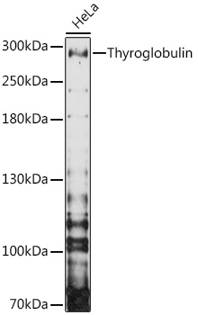 TG antibody