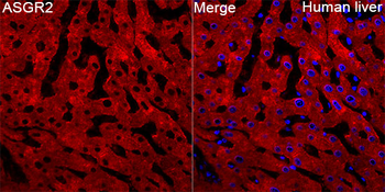 ASGR2 antibody