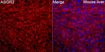 ASGR2 antibody