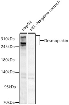 DSP antibody