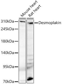 DSP antibody