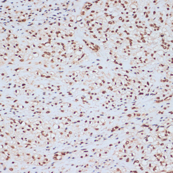 MAPK3 (Phospho-Y204) antibody