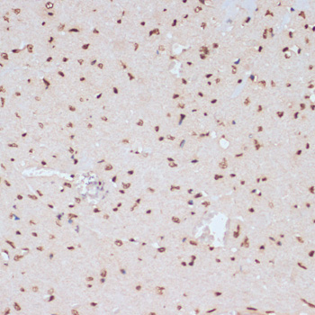 MAPK3 (Phospho-Y204) antibody