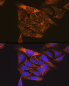 FLT1 antibody