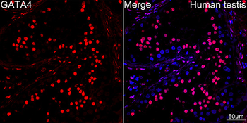 GATA4 antibody