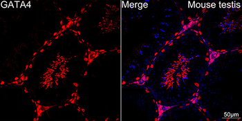 GATA4 antibody