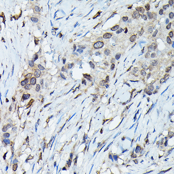 C9orf72 antibody