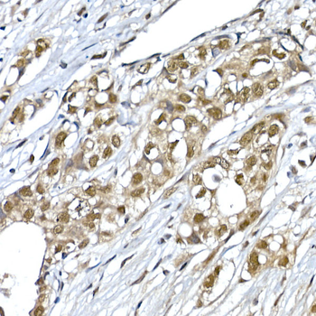 SNRPD1 antibody