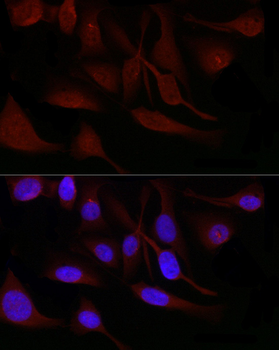 SNRPD1 antibody