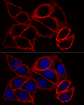 CD44 antibody