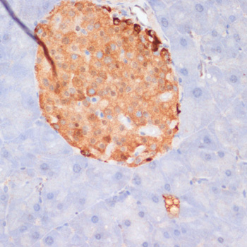 ACLY (Phospho-S455) antibody