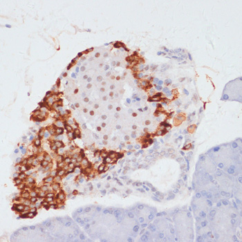 ACLY (Phospho-S455) antibody