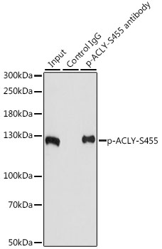 ACLY (Phospho-S455) antibody