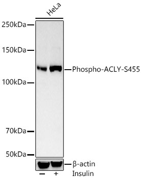 ACLY (Phospho-S455) antibody