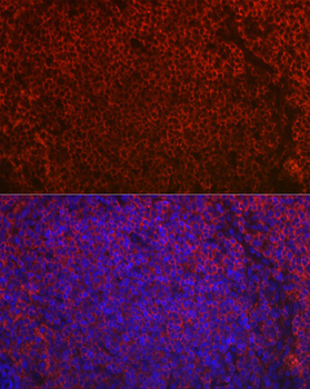 CD79A antibody