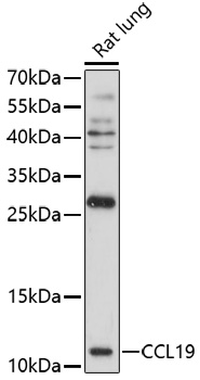 MIP3 beta antibody