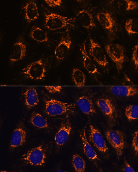 ACAA2 antibody