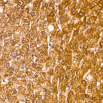 ACAA2 antibody