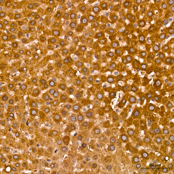 ACAA2 antibody