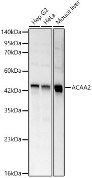 ACAA2 antibody